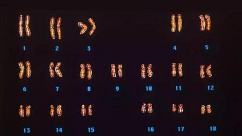 人类染色体数发现史：一位华裔科学家的孤独挑战