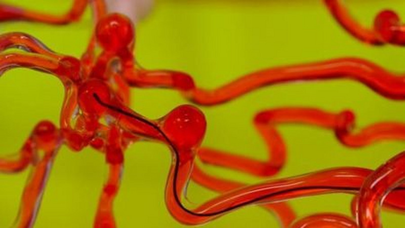 MIT华人科学家打造磁控线形机器人：可在脑血管中游走？
