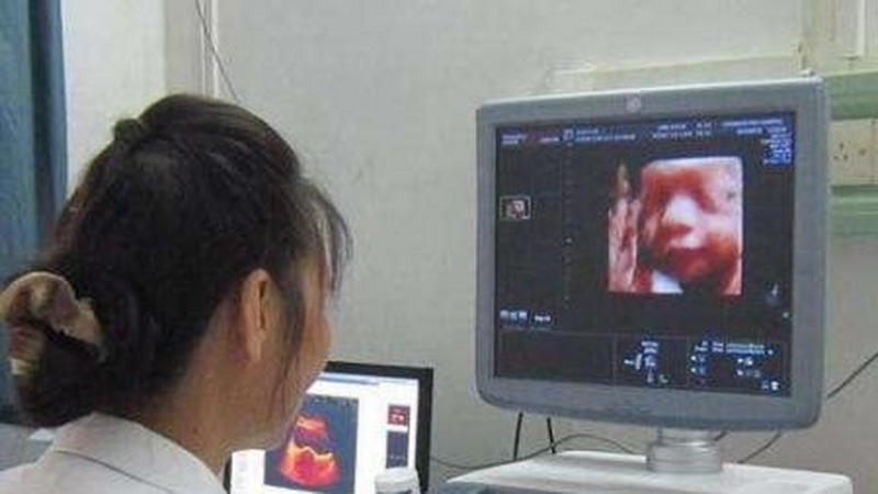 四维女宝生下来却是男宝，四维翻盘可能是这3个原因
