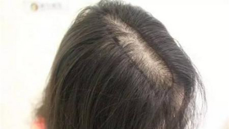 产后减肥，只吃菜不吃饭，科学吗？